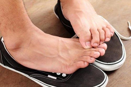 Công thức khử mùi hôi chân dứt điểm tại nhà