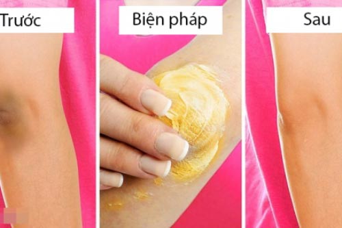 4 cách trị thâm đầu gối, khuỷu tay từ thiên nhiên