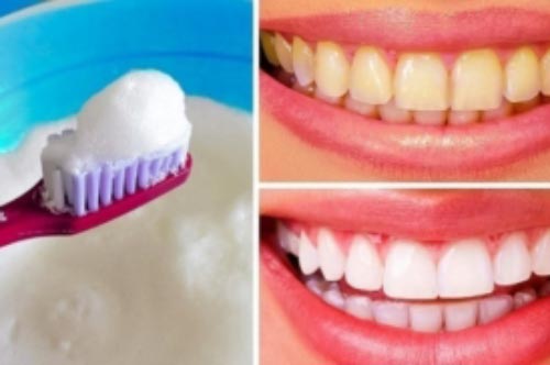 Làm trắng răng tại nhà chỉ trong 2 phút bằng nguyên liệu tự nhiên, không lo ê buốt