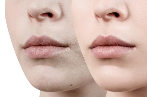 Thoát khỏi tình trạng môi thâm xỉn màu với nguyên tắc đơn giản