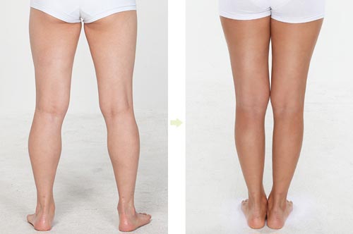 Cách làm giảm mỡ đùi cực dễ mà phụ nữ nên biết