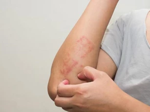Ngứa hai bộ phận này: Bạn nên cẩn trọng kẻo ung thư gan gõ cửa