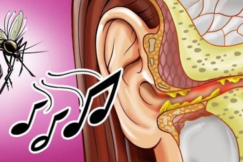 Vì sao có tiếng muỗi vo ve bên tai khi ngủ?