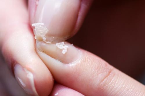 Dấu hiệu cảnh báo xương có vấn đề