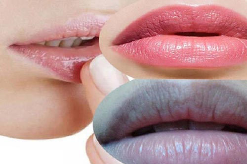 Lý do khiến môi thâm bạn không ngờ tới