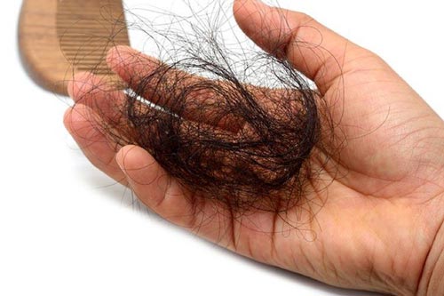 2 cách chữa rụng tóc đơn giản bạn phải biết