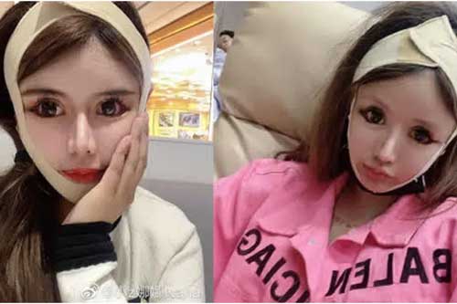 Cuồng thẩm mỹ, nữ sinh trung học "đập mặt xây lại" hơn 100 lần trong 3 năm: Bất chấp tai tiếng để vươn tới ước mơ làm idol