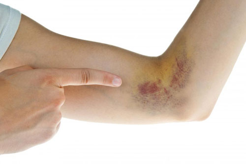 Dấu hiệu trên da cảnh báo bạn đang mắc trọng bệnh, hãy đi khám ngay kẻo hối hận