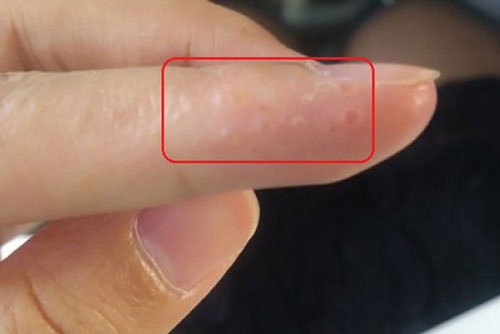 Thấy tay có dấu hiệu này hãy nhanh chân tới bệnh viện ngay