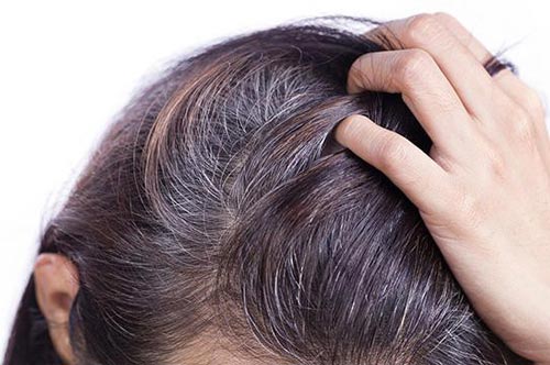 Đây là lý do khiến tóc bạc sớm