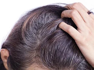 Đây là lý do khiến tóc bạc sớm
