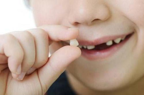 Thấy răng con bị lung lay: Nên chờ tự rụng hay đến nha sĩ?