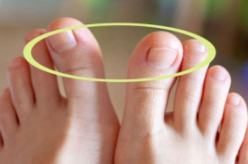 Nhìn xuống bàn chân nếu thấy 2 biểu hiện này, bạn là người nhiều bệnh tật, có tuổi thọ kém