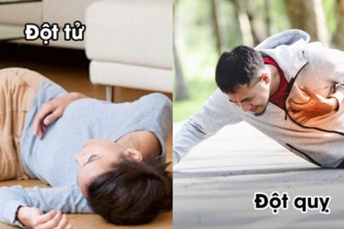 Đột tử và đột quỵ khác nhau như thế nào?