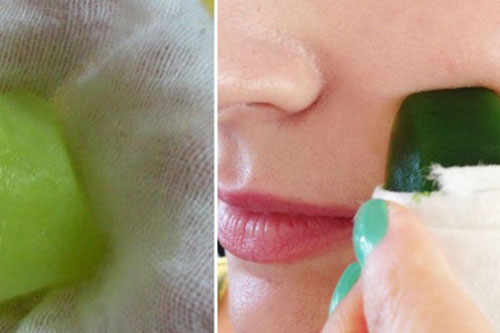 Mụn "xẹp" nhanh chóng để đón Tết với cách vô cùng đơn giản