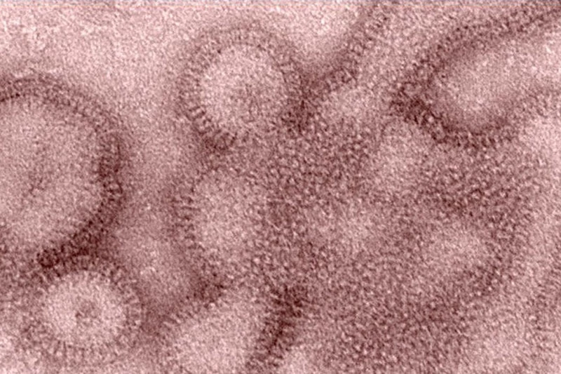 Ảnh: Một hình ảnh dưới kính hiển vi điện tử do Trung tâm Kiểm soát và Phòng ngừa Dịch bệnh Hoa Kỳ cung cấp vào năm 2011 cho thấy vi rút cúm H3N2. 