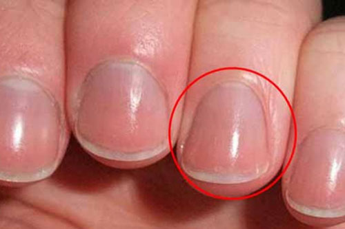 Người khỏe mạnh, sống trường thọ thường có 4 dấu hiệu trên bàn tay: Bạn có bao nhiêu?