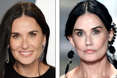 Minh tinh Demi Moore gợi cảm diễn thời trang, mặt khác lạ nghi phẫu thuật thẩm mỹ