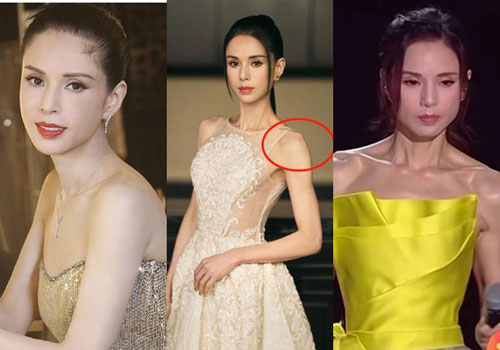 'Tiểu Long Nữ đẹp nhất màn ảnh': Nặng 41 cân thân hình xương xẩu, nhìn đôi vai mới sợ