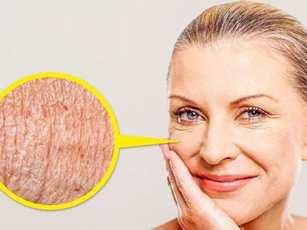 8 dấu hiệu trên khuôn mặt báo hiệu sự lão hóa