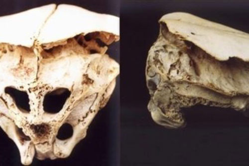 Bí ẩn đằng sau những bộ hài cốt giống người ngoài hành tinh