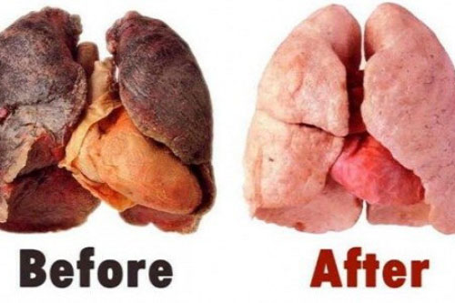 Phổi nám đen đến mấy vì hút thuốc lâu năm cũng trở lại nhờ nước này