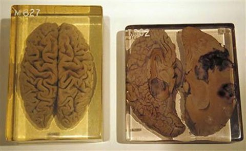 Khám phá những bí mật của bộ não người