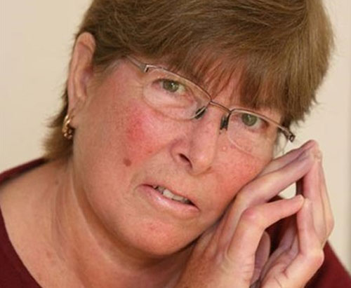 Bệnh lạ giúp phụ nữ mãi trẻ