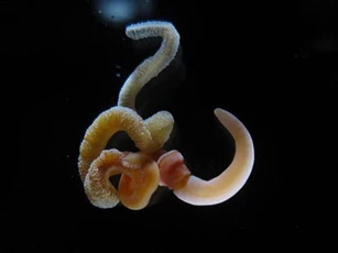 Não người giống não giun?