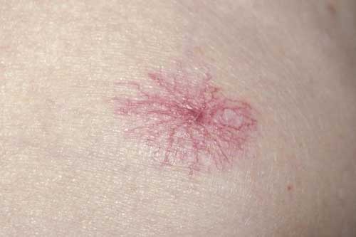 5 tín hiệu ít ai ngờ báo hiệu bạn cần đến bệnh viện ngay