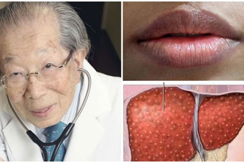 Dấu hiệu '3 vàng, 1 hôi, 1 đen' chứng tỏ gan rất yếu, đi khám ngay kẻo gan 'nát bét'