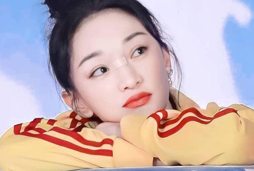 Châu Tấn bị chấn thương ở mũi, nghe xong nguyên nhân ai nấy đều 'cười té ghế'