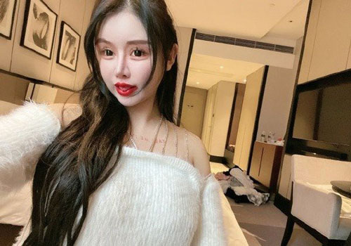 Thiếu nữ 16 tuổi phẫu thuật thẩm mỹ 100 lần trong ba năm