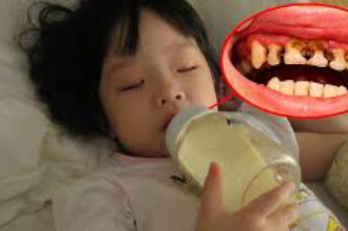 Thói quen tai hại khiến trẻ sâu răng, hô răng, cha mẹ nhớ nhắc bé ngay
