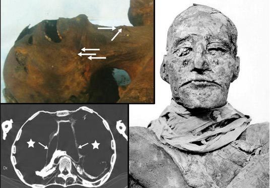 Hé lộ vụ ám sát dã man vua pharaoh Ai Cập