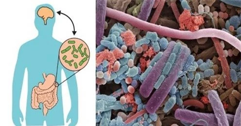 Bệnh trầm cảm có thể bắt nguồn từ vi khuẩn trong bụng?