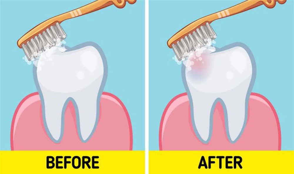 Lời khuyên của nha sĩ về việc nên đánh răng trước hay sau bữa sáng