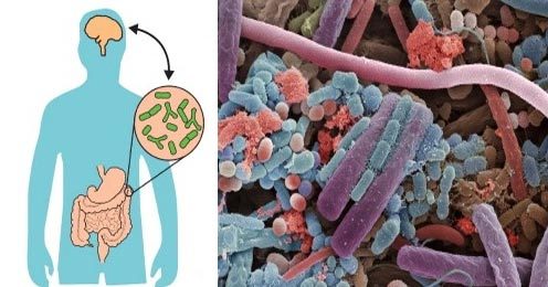 Bệnh trầm cảm có thể bắt nguồn từ vi khuẩn trong bụng?