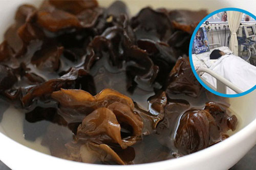 3 đại kỵ khi chế biến mộc nhĩ: Bà nội trợ nào cũng phải biết để tránh rước bệnh cho gia đình