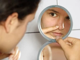 Đoán bệnh từ vị trí mọc mụn trên mặt