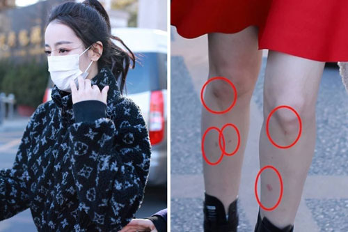 Mặc đồ hàng hiệu nhưng 'mỹ nhân Tân Cương' Địch Lệ Nhiệt Ba lại để lộ đôi chân hoa gấm