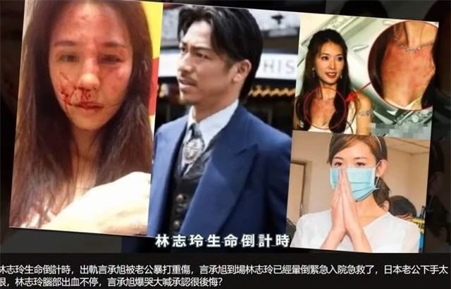 Nhiều người hoang mang khi nghe tin Lâm Chí Linh bị chồng bạo hành.