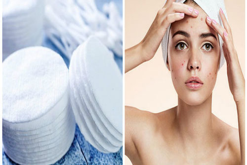 Làn da bị 'tàn phá' trầm trọng vì sai lầm khi dùng bông tẩy trang nhiều người đang mắc