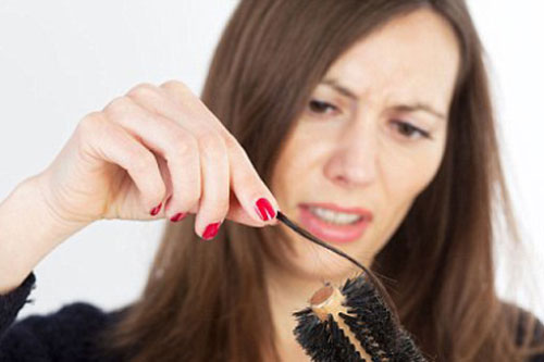 Chữa rụng tóc sau sinh vô cùng hiệu quả