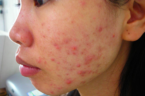 Thói quen khiến bạn bị hủy hoại nhan sắc