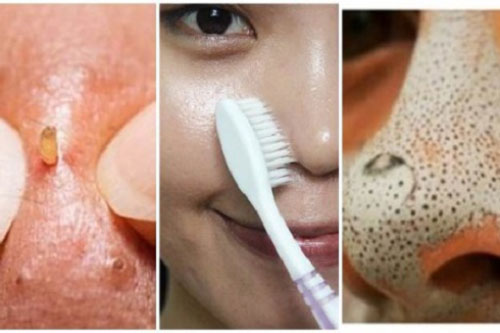 Làm đẹp da chỉ bằng bàn chải đánh răng