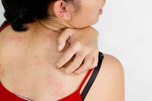 Thấy 4 dấu hiệu này hãy đi khám ung thư ngay kẻo giai đoạn cuối