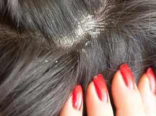 Biết cách gội đầu bạn sẽ không cần phải lo về gàu
