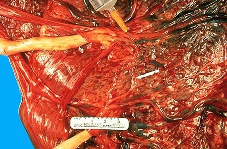 Những thực phẩm dị thường lấy nguyên liệu từ ... người