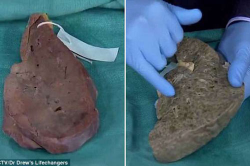 3 bộ phận trên cơ thể càng mềm: Bạn càng khỏe mạnh, sống lâu trường thọ